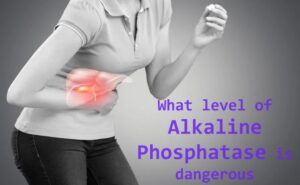 What-level-of-Alkaline-Phosphatase-is-dangerous