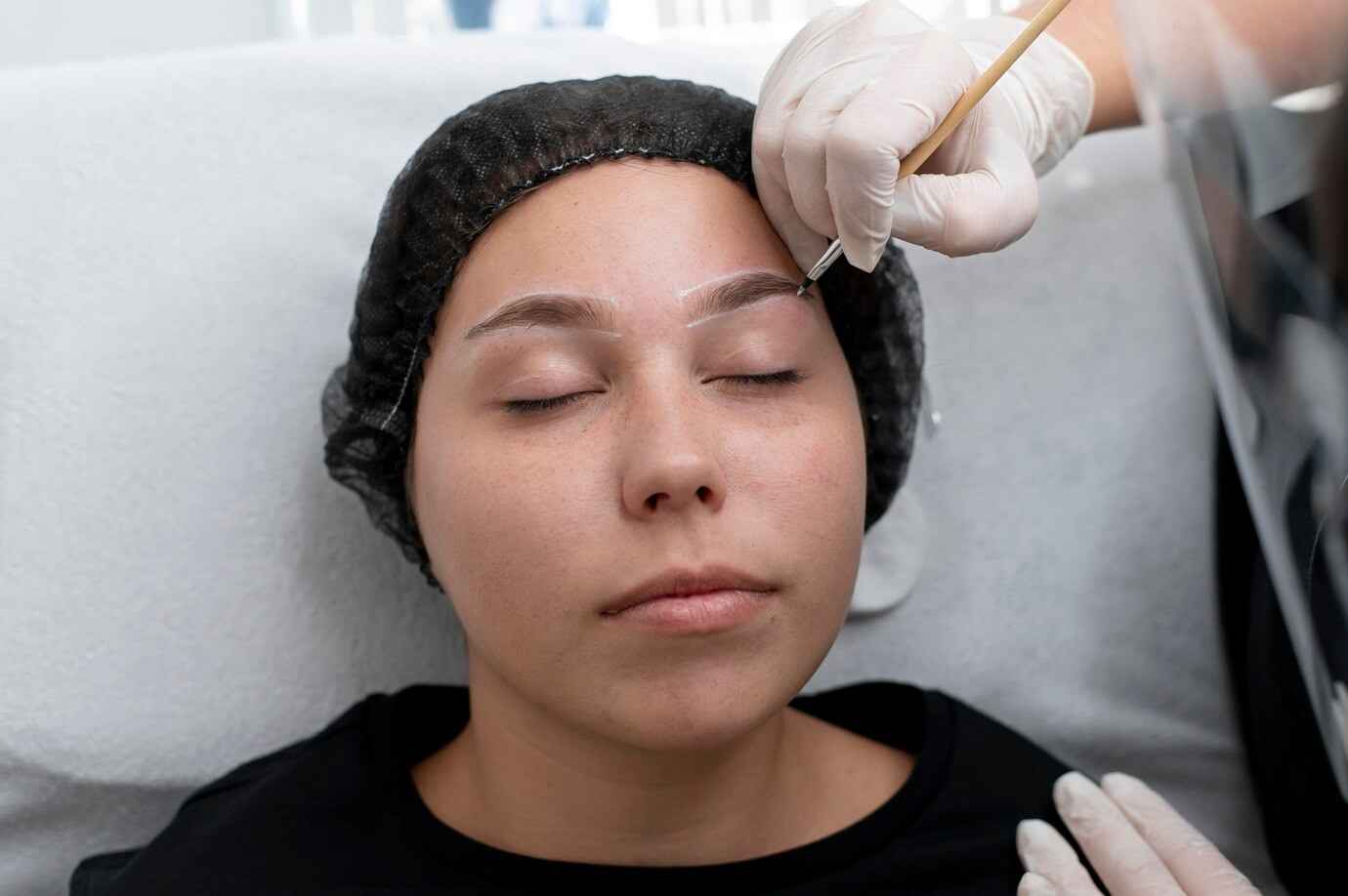 Eyebrow-Hair-Transplant