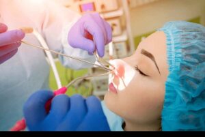 Sinus-Surgery-Singapore