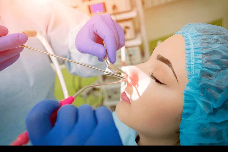 Sinus-Surgery-Singapore