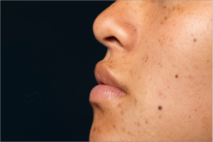 Dark Spot