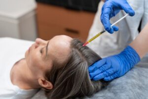 Tips for Choosing Between FUT and FUE in Melbourne
