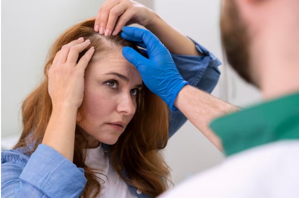 Tips for Selecting a Specialist in Female Hair Loss Treatment