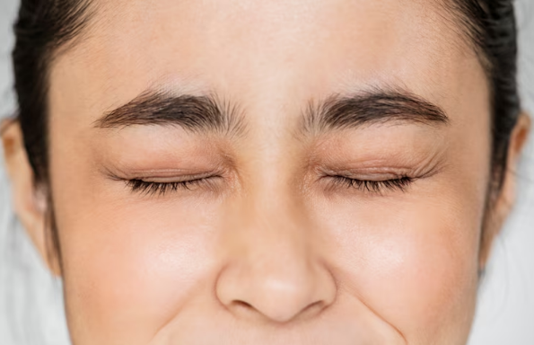 Signs You May Have Brow Ptosis
