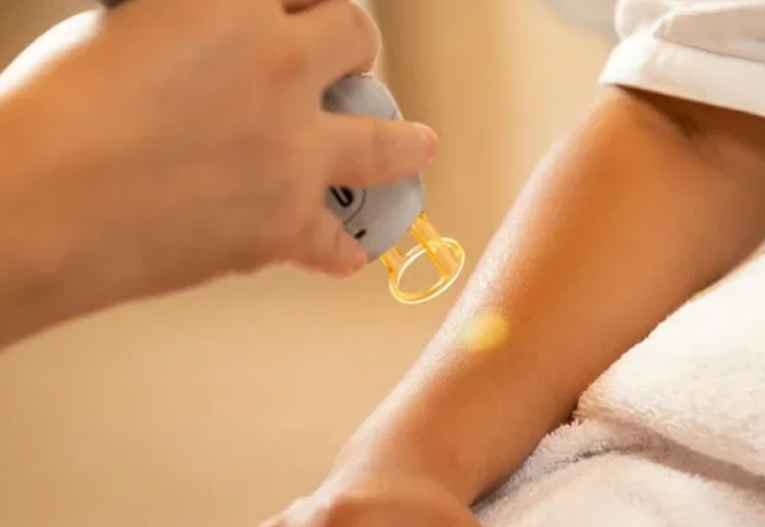 Laser-Tattoo-Removal-Services