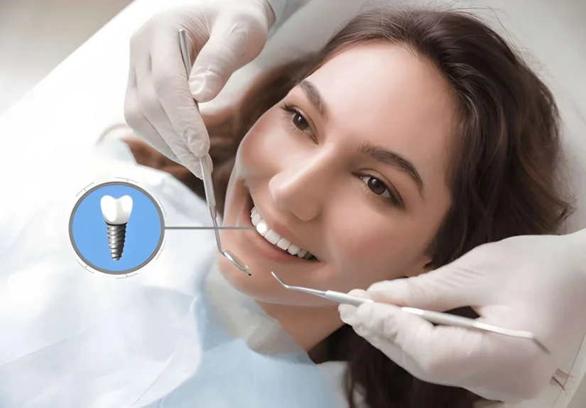 dental-implants-abroad
