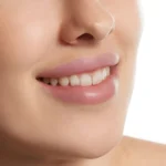 non-surgical-dental-facelift