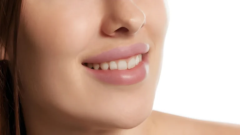 non-surgical-dental-facelift