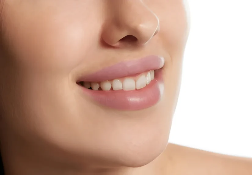 non-surgical-dental-facelift